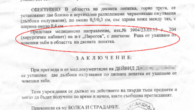 Дете отхапа парче месо от съученик?!

